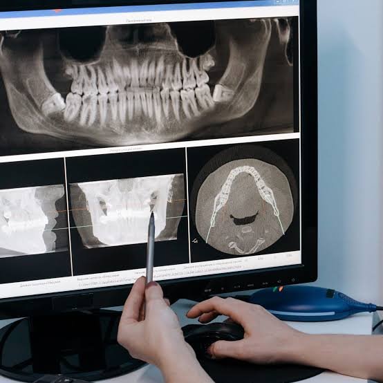 Genoray Papaya 3D Plus CBCT machine